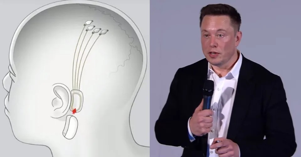 Cyberpunk 2020, czyli Elon Musk chce nam wszczepia implanty do mzgw