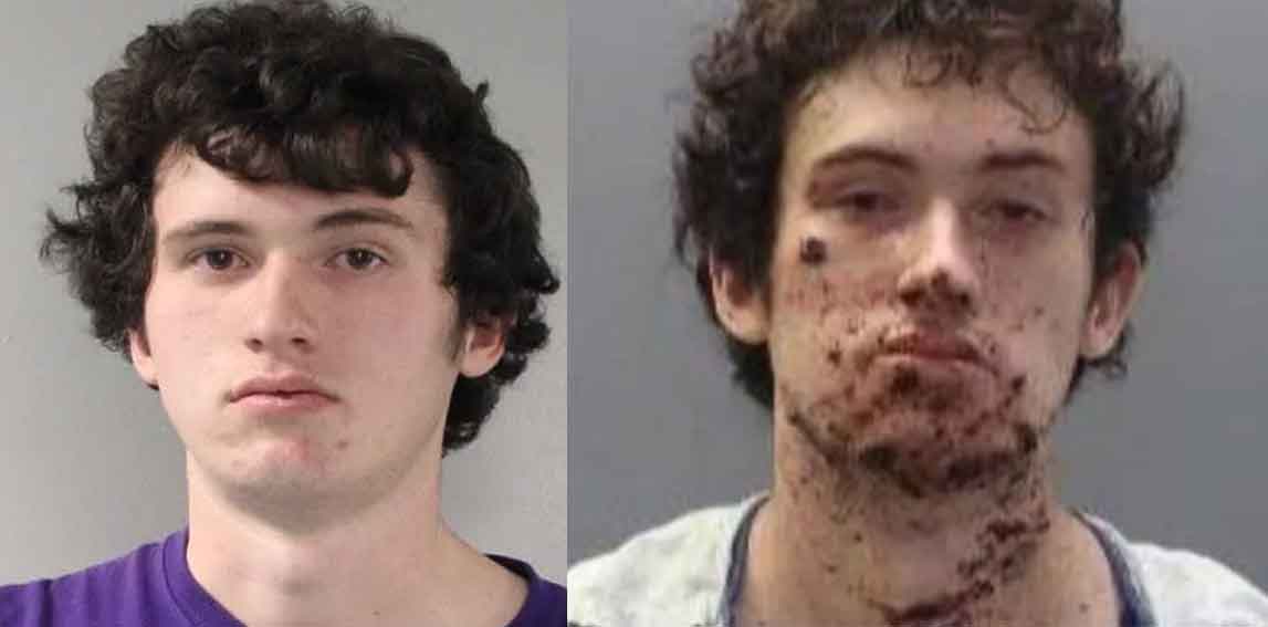 Smutny chłopak z problemami stracił rękę po nieudanej próbie skonstruowania bomby Smutny chłopak z problemami stracił rękę po nieudanej próbie skonstruowania bomby